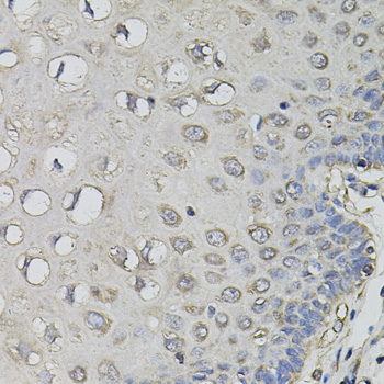 Immunohistochemistry - AMPD1 Polyclonal Antibody 
