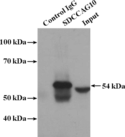 IP Result of anti-SDCCAG10 (IP:Catalog No:115026, 4ug; Detection:Catalog No:115026 1:500) with HepG2 cells lysate 2400ug.