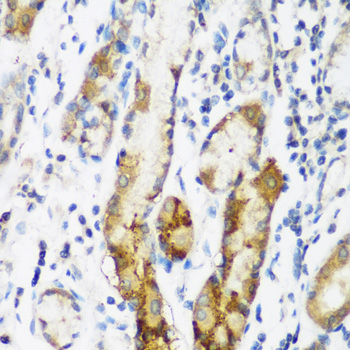 Immunohistochemistry - NAA60 Polyclonal Antibody 