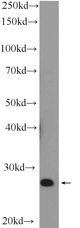 MCF-7 cells were subjected to SDS PAGE followed by western blot with Catalog No:113280(NRIP3 Antibody) at dilution of 1:300