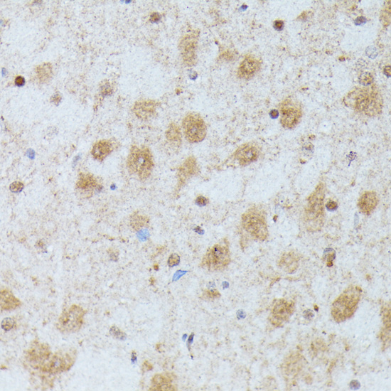 Immunohistochemistry - ID2 Polyclonal Antibody 