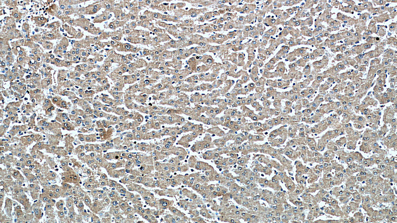 Immunohistochemistry of paraffin-embedded human liver tissue slide using Catalog No:107465(PEX5 Antibody) at dilution of 1:200 (under 10x lens).