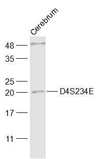 Fig4: Sample:; Cerebrum (Mouse) Lysate at 40 ug; Primary: Anti-D4S234E at 1/1000 dilution; Secondary: IRDye800CW Goat Anti-Rabbit IgG at 1/20000 dilution; Predicted band size: 21 kD; Observed band size: 21 kD