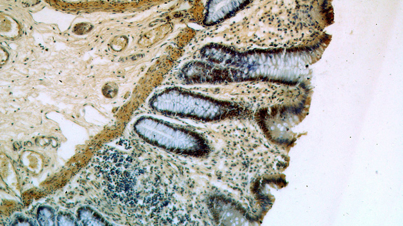 Immunohistochemical of paraffin-embedded human colon using Catalog No:114191(PRICKLE3 antibody) at dilution of 1:50 (under 10x lens)