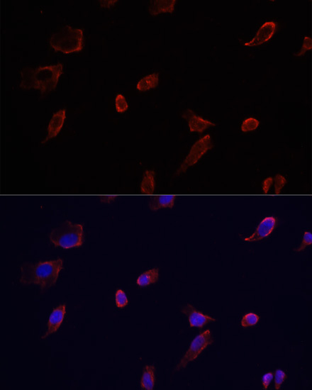 Immunofluorescence - AQP3 Polyclonal Antibody 