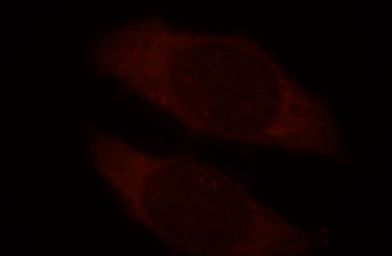 Immunofluorescent analysis of MCF-7 cells, using TROAP antibody Catalog No:116402 at 1:25 dilution and Rhodamine-labeled goat anti-rabbit IgG (red).