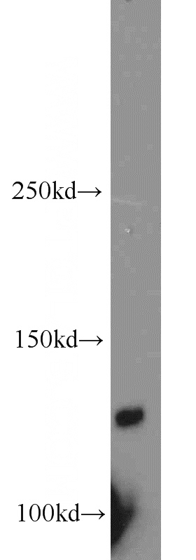mouse testis tissue were subjected to SDS PAGE followed by western blot with Catalog No:113957(PLEKHA5 antibody) at dilution of 1:500