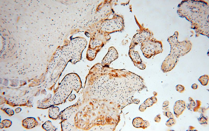 Immunohistochemical of paraffin-embedded human placenta using Catalog No:109389(CLIC3 antibody) at dilution of 1:50 (under 10x lens)