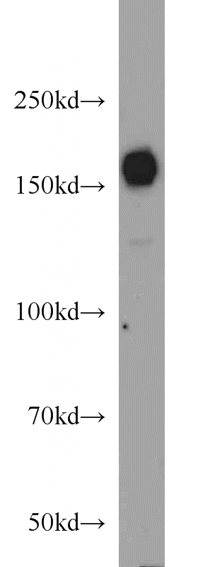 K-562 cells were subjected to SDS PAGE followed by western blot with Catalog No:111380(HDAC6 antibody) at dilution of 1:1000