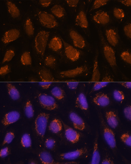 Immunofluorescence - ACAT1 Polyclonal Antibody 