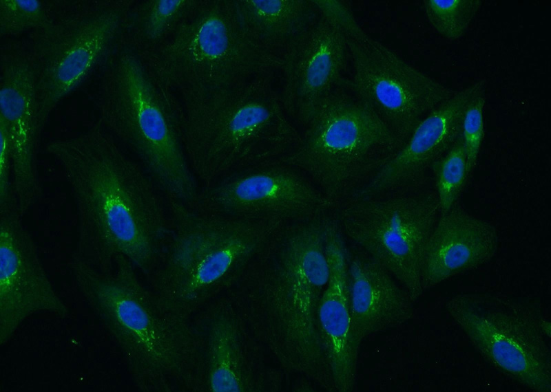 Immunofluorescent analysis of A549 cells using Catalog No:116032(TGOLN2,TGN46 Antibody) at dilution of 1:25 and Alexa Fluor 488-congugated AffiniPure Goat Anti-Rabbit IgG(H+L)