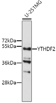 Western blot - YTHDF2 Polyclonal Antibody 