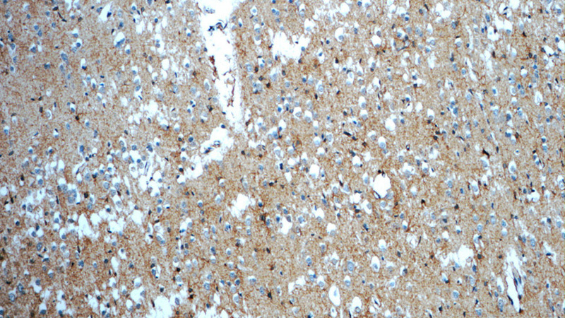 Immunohistochemistry of paraffin-embedded human brain slide using Catalog No:108345(ATP1B2 Antibody) at dilution of 1:50