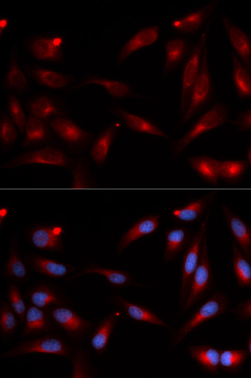 Immunofluorescence - ADAM9 Polyclonal Antibody 