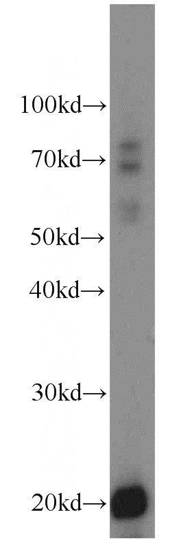mouse pancreas tissue were subjected to SDS PAGE followed by western blot with Catalog No:116184(TMEM27 antibody) at dilution of 1:500