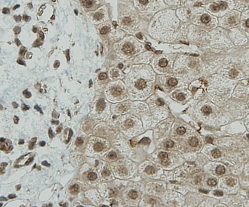 Fig4: Immunohistochemical analysis of paraffin-embedded human liver tissue using anti-CCDC51 antibody. Counter stained with hematoxylin.