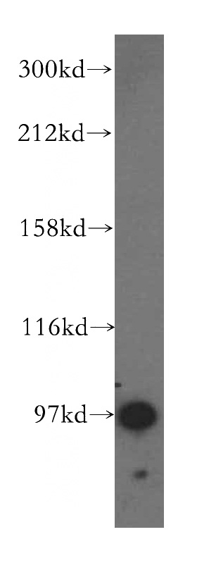 human brain tissue were subjected to SDS PAGE followed by western blot with Catalog No:111210(GRIPAP1 antibody) at dilution of 1:500