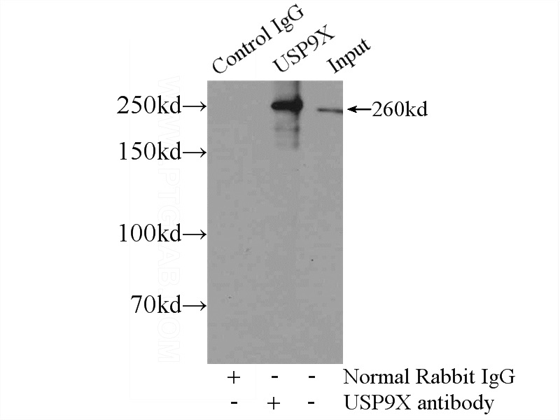 IP Result of anti-USP9X (IP:Catalog No:116692, 5ug; Detection:Catalog No:116692 1:500) with HEK-293 cells lysate 2400ug.