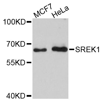 Western blot - SREK1 Polyclonal Antibody 