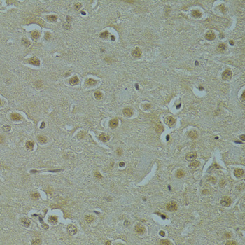 Immunohistochemistry - RSRC1 Polyclonal Antibody 
