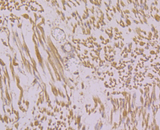 Fig2: Immunohistochemical analysis of paraffin-embedded human fetal skeletal muscle tissue using anti-RYR1 antibody. Counter stained with hematoxylin.