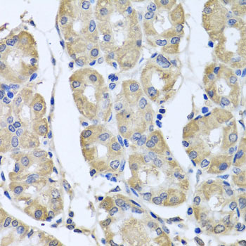 Immunohistochemistry - BAG5 Polyclonal Antibody 