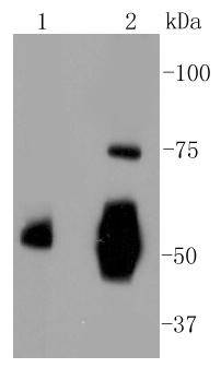 Fig1:; Western blot analysis of Vitronectin on different lysates. Proteins were transferred to a PVDF membrane and blocked with 5% BSA in PBS for 1 hour at room temperature. The primary antibody ( 1/500) was used in 5% BSA at room temperature for 2 hours. Goat Anti-Rabbit IgG - HRP Secondary Antibody (HA1001) at 1:5,000 dilution was used for 1 hour at room temperature.; Positive control:; Lane 1: Human liver tissue lysate; Lane 2: Human serum lysate