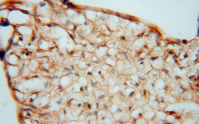 Immunohistochemical of paraffin-embedded human placenta using Catalog No:112031(KDSR antibody) at dilution of 1:50 (under 40x lens)