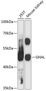Western blot - GNAL Polyclonal Antibody 