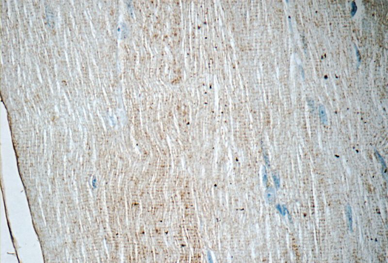 Immunohistochemistry of paraffin-embedded human skeletal muscle tissue slide using Catalog No:114083(PPARA Antibody) at dilution of 1:50 (under 40x lens)