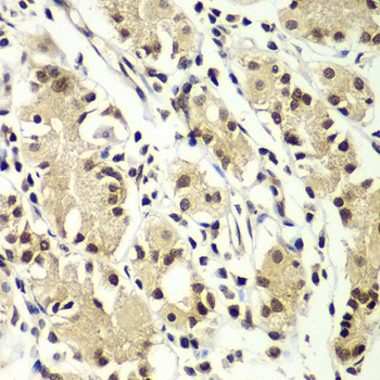 Immunohistochemistry - ZNF264 Polyclonal Antibody 