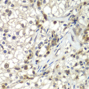 Immunohistochemistry - ASPSCR1 Polyclonal Antibody 