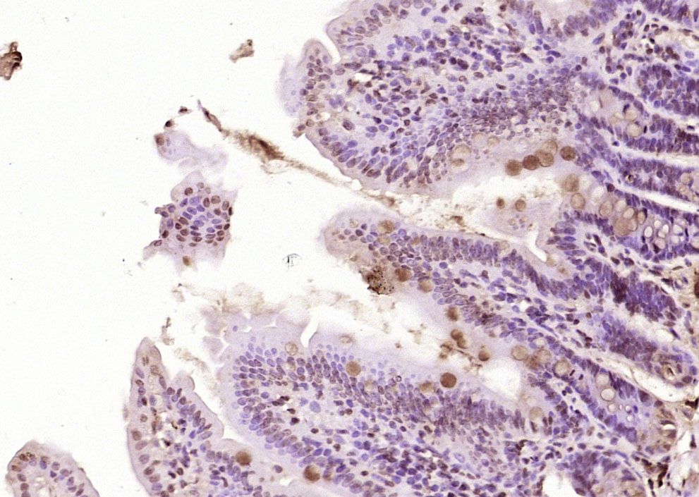 Fig3: Paraformaldehyde-fixed, paraffin embedded (Mouse intestine); Antigen retrieval by boiling in sodium citrate buffer (pH6.0) for 15min; Block endogenous peroxidase by 3% hydrogen peroxide for 20 minutes; Blocking buffer (normal goat serum) at 37℃ for 30min; Antibody incubation with (HBP1) Polyclonal Antibody, Unconjugated at 1:400 overnight at 4℃, followed by operating according to SP Kit(Rabbit) (sp-0023) instructionsand DAB staining.
