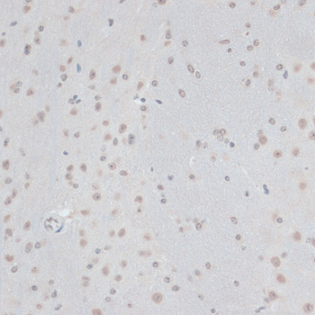 Immunohistochemistry - ZNF574 Polyclonal Antibody 