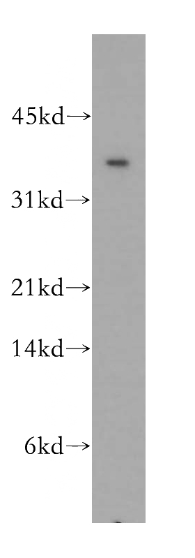 mouse liver tissue were subjected to SDS PAGE followed by western blot with Catalog No:109310(CIAPIN1 antibody) at dilution of 1:400