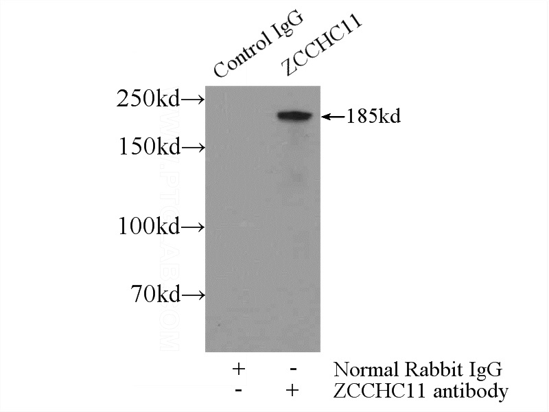 IP Result of anti-ZCCHC11 (IP:Catalog No:116932, 5ug; Detection:Catalog No:116932 1:1000) with MCF-7 cells lysate 2000ug.