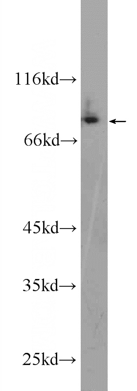A375 cells were subjected to SDS PAGE followed by western blot with Catalog No:109507(CPEB4 Antibody) at dilution of 1:600