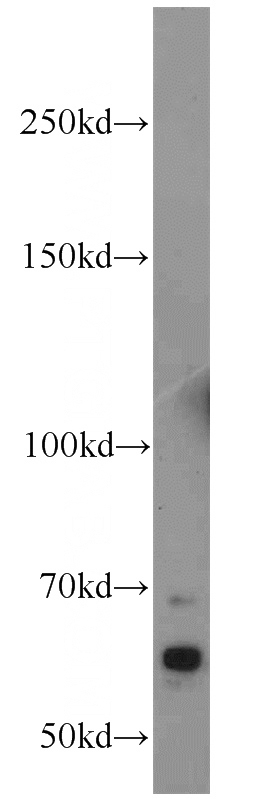 mouse brain tissue were subjected to SDS PAGE followed by western blot with Catalog No:111563(HSN2 antibody) at dilution of 1:1000