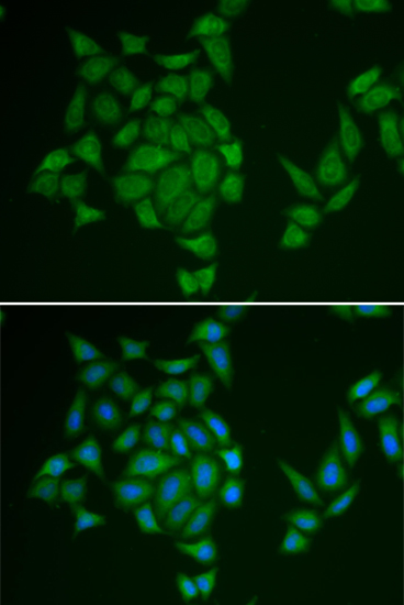 Immunofluorescence - AMPD3 Polyclonal Antibody 
