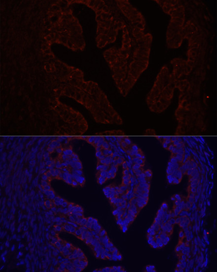 Immunofluorescence - COL1A1 Polyclonal Antibody 