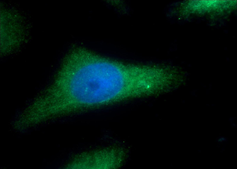 Immunofluorescent analysis of HeLa cells using Catalog No:115162(SGCE Antibody) at dilution of 1:25 and Alexa Fluor 488-congugated AffiniPure Goat Anti-Rabbit IgG(H+L)