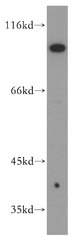 HL-60 cells were subjected to SDS PAGE followed by western blot with Catalog No:114327(PTPRE antibody) at dilution of 1:300