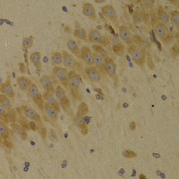 Immunohistochemistry - SCO2 Polyclonal Antibody 
