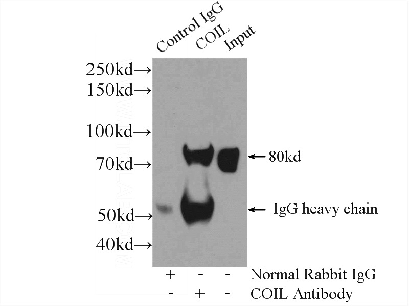 IP Result of anti-COIL (IP:Catalog No:109372, 3ug; Detection:Catalog No:109372 1:500) with HEK-293 cells lysate 1000ug.