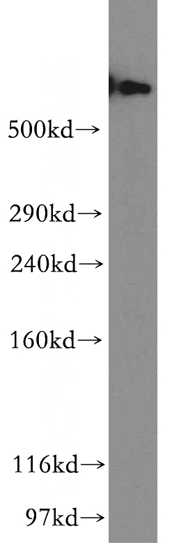 HeLa cells were subjected to SDS PAGE followed by western blot with Catalog No:110134(KIAA0325 antibody) at dilution of 1:500