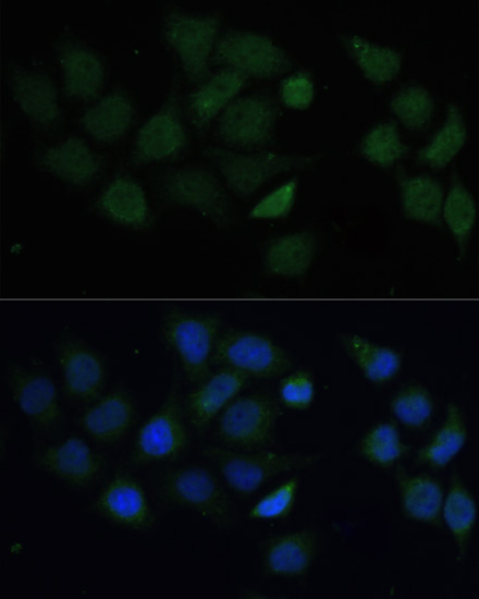 Immunofluorescence - CPT2 Polyclonal Antibody 