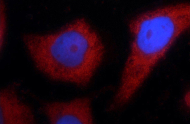 Immunofluorescent analysis of MCF-7 cells using Catalog No:112197(LEPR Antibody) at dilution of 1:25 and Rhodamine-Goat anti-Rabbit IgG