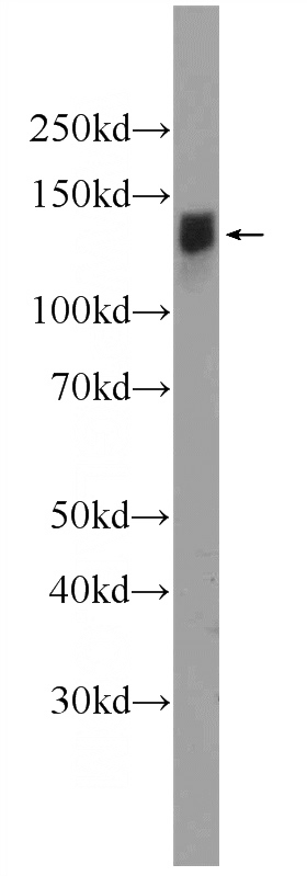 mouse testis tissue were subjected to SDS PAGE followed by western blot with Catalog No:111663(IFT122 Antibody) at dilution of 1:300