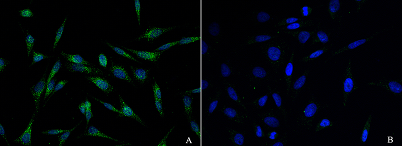 BRCA1 Antibody, Rabbit PAb, Antigen Affinity Purified, Immunofluorescence