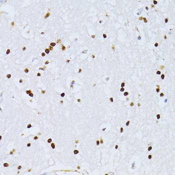 Immunohistochemistry - ZEB2 Polyclonal Antibody 